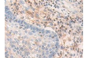 Immunohistochemistry (IHC) image for anti-Pyridoxal Kinase (PDXK) (AA 29-253) antibody (ABIN7440257)