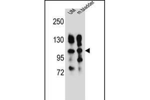 ITGA5 Antibody (Center) (ABIN656138 and ABIN2845477) western blot analysis in human uterine tumor and mouse bladder tissue lysates (35 μg/lane). (ITGA5 antibody  (AA 575-602))