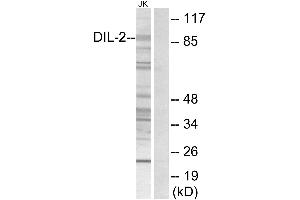 Immunohistochemistry analysis of paraffin-embedded human brain tissue using DIL-2 antibody. (TPX2 antibody)