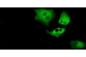 Image no. 6 for anti-Bruton Agammaglobulinemia tyrosine Kinase (BTK) antibody (ABIN1496972) (BTK antibody)