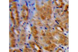 Used in DAB staining on fromalin fixed paraffin-embedded Kidney tissue (IL1RL1 antibody  (AA 162-349))