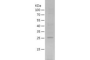 Peroxiredoxin 6 Protein (PRDX6) (AA 2-224) (His tag)