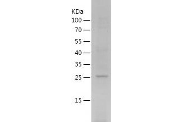 Peroxiredoxin 6 Protein (PRDX6) (AA 2-224) (His tag)