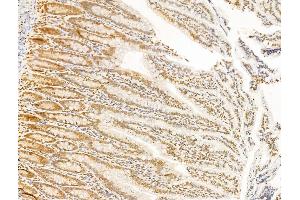 ABIN6265564 and ABIN6273020 at 1/100 staining Rat colon tissue by IHC-P.