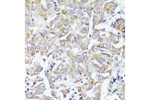 Immunohistochemistry (IHC) image for anti-Eukaryotic Translation Initiation Factor 3, Subunit L (EIF3L) (AA 1-230) antibody (ABIN6140074)