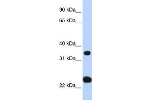 SLC25A35 antibody used at 1 ug/ml to detect target protein.