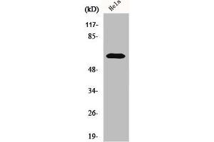 Western Blot analysis of HeLa cells using KOX11 Polyclonal Antibody (ZNF18 antibody  (Internal Region))