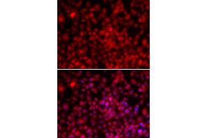 Immunofluorescence analysis of U2OS cells using ILF2 antibody (ABIN6290505).