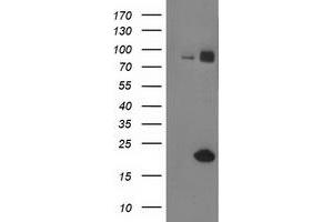 HEK293T cells were transfected with the pCMV6-ENTRY control (Left lane) or pCMV6-ENTRY GUK1 (Right lane) cDNA for 48 hrs and lysed. (GUK1 antibody)