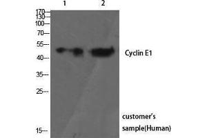 Western Blotting (WB) image for anti-Cyclin E1 (CCNE1) (Ser21) antibody (ABIN3174622) (Cyclin E1 antibody  (Ser21))
