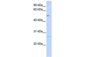 Image no. 1 for anti-Protein Phosphatase 1M (PP2C Domain Containing) (PPM1M) (AA 72-121) antibody (ABIN6741162) (PPM1M antibody  (AA 72-121))