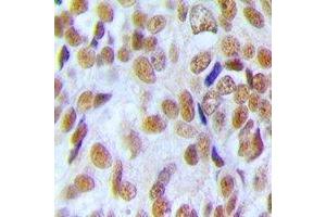 Immunohistochemistry (IHC) image for anti-U2 Small Nuclear RNA Auxiliary Factor 1 (U2AF1) antibody (ABIN7308460) (U2AF1 antibody)