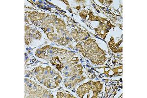 Immunohistochemistry of paraffin-embedded human stomach using CDH6 antibody (ABIN5974784) at dilution of 1/100 (40x lens).