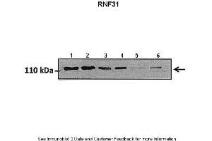 Lanes:   Lane1: 50 ug hormoxia A549 lysate Lane2: 50 ug hypoxia A549 lysate Lane3: 50 ug hormoxia A549 lysate (+scrambled siRNA) Lane4: 50 ug hypoxia A549 lysate (+scrambled siRNA) Lane5: 50 ug hormoxia A549 lysate (RNF31 siRNA) Lane6: 50 ug hypoxia A549 lysate (RNF31 siRNA)  Primary Antibody Dilution:   1:800  Secondary Antibody:   Goat anti rabbit HRP   Secondary Antibody Dilution:   1:10000  Gene Name:   RNF31  Submitted by:   Markus Queisser, Northwestern University (RNF31 antibody  (Middle Region))