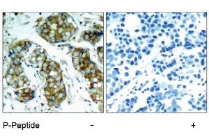 Image no. 1 for anti-Cell Division Cycle 25 Homolog A (S. Pombe) (CDC25A) (pSer75), (pSer76) antibody (ABIN196853) (CDC25A antibody  (pSer75, pSer76))