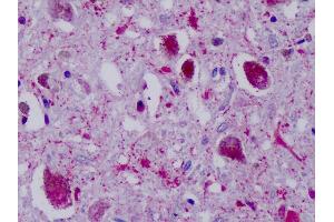 Anti-PPYR1 antibody IHC of human brain, substantia nigra. (NPY4R antibody  (Cytoplasmic Domain))