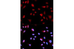 Immunofluorescence analysis of MCF-7 cells using Phospho-ABL1-Y204 antibody (ABIN5969866).