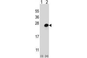 Western blot analysis of MGMT (arrow) using rabbit polyclonal MGMT Antibody (N-term).