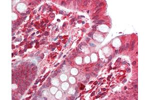 Anti-SGSM2 antibody IHC staining of human colon. (SGSM2 antibody  (Internal Region))