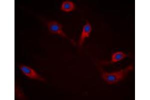 Immunofluorescent analysis of Alpha-synuclein (pS129) staining in HEK293T cells. (SNCA antibody  (C-Term, pSer129))