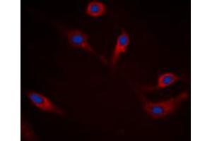 Immunofluorescent analysis of Alpha-synuclein (pS129) staining in HEK293T cells.