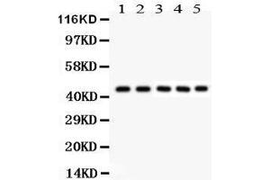 Anti- PIM1Picoband antibody, Western blotting All lanes: Anti PIM1  at 0. (PIM1 antibody  (C-Term))