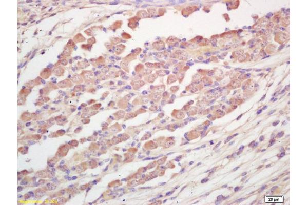 TRAK1 antibody  (AA 171-270)