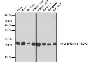 Western blot analysis of extracts of various cell lines, using Peroxiredoxin 2 (PRDX2) (PRDX2) Rabbit mAb (ABIN7269234) at 1:1000 dilution. (Peroxiredoxin 2 antibody)