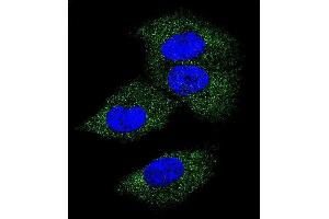 Confocal immunofluorescent analysis of M-CSF Antibody (Center) (ABIN390719 and ABIN2840996) with MDA-M cell followed by Alexa Fluor 488-conjugated goat anti-rabbit lgG (green).