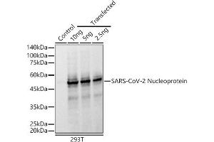 Western blot analysis of extracts of normal 293T cells and 293T transfected with Nucleoprotein Protein, using SARS-CoV-2 Nucleoprotein antibody (ABIN7269052) at 1:10000 dilution. (Nucleoprotein antibody)