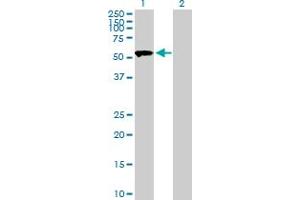 Western Blot analysis of SASS6 expression in transfected 293T cell line by SASS6 MaxPab polyclonal antibody. (SASS6 antibody  (AA 1-490))
