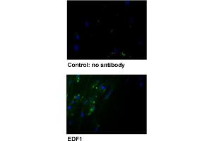 Immunofluorescent staining of human fibroblast with EDF1 polyclonal antibody .