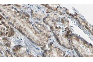 ABIN6276636 at 1/100 staining Human prostate tissue by IHC-P. (TNFRSF10B antibody  (N-Term))