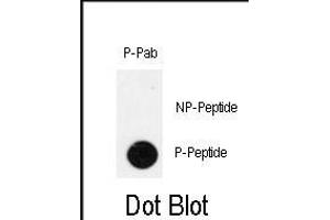 Dot blot analysis of anti-Phospho-IPF-pT11 Antibody (ABIN390000 and ABIN2839777) on nitrocellulose membrane. (PDX1 antibody  (pThr11))