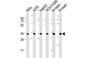 All lanes : Anti-PDHB Antibody (C-term) at 1:2000 dilution Lane 1: Hela whole cell lysates Lane 2:  whole cell lysates Lane 3: HepG2 whole cell lysates Lane 4: NCI- whole cell lysates Lane 5: mouse heart lysates Lane 6: rat heart lysates Lysates/proteins at 20 μg per lane. (PDHB antibody  (C-Term))