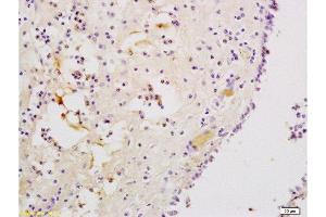 Formalin-fixed and paraffin embedded human nasal mucosa tissue labeled with Anti-CXCR3/CD183 Polyclonal Antibody, Unconjugated  at 1:200, followed by conjugation to the secondary antibody and DAB staining (CXCR3 antibody  (AA 1-100))