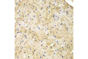 Immunohistochemistry of paraffin-embedded mouse heart using IDH1 antibody at dilution of 1:100 (400x lens). (IDH1 antibody)