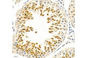 Immunohistochemistry (Paraffin-embedded Sections) (IHC (p)) image for anti-Inositol 1,4,5,-Tris-Phosphate Receptor (ITP-R83A) antibody (ABIN7074293)