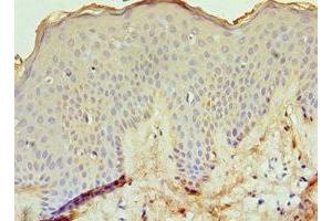 Immunohistochemistry of paraffin-embedded human skin tissue using ABIN7151764 at dilution of 1:100