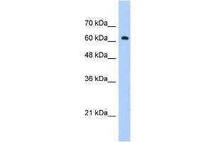 WB Suggested Anti-ZNF675 Antibody Titration:  1. (ZNF675 antibody  (C-Term))
