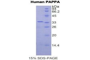 SDS-PAGE (SDS) image for Pregnancy-Associated Plasma Protein A, Pappalysin 1 (PAPPA) (AA 1270-1558) protein (His tag) (ABIN2121932)