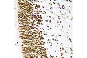 Immunohistochemistry of paraffin-embedded Human embryo brain using H3R8me2s antibody at dilution of 1:100 (x400 lens). (Histone 3 antibody  (H3R8me2s))