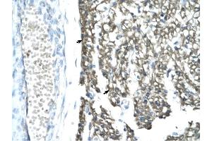 MORF4L1 antibody was used for immunohistochemistry at a concentration of 4-8 ug/ml to stain Myocardial cells (arrows) in Human Heart. (MORF4L1 antibody  (Middle Region))
