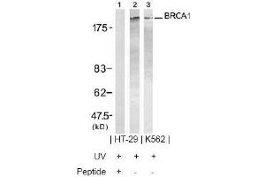 Image no. 2 for anti-Breast Cancer 1 (BRCA1) (Ser1423) antibody (ABIN197480)