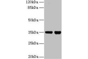 Western blot All lanes: ZBED1 antibody at 2 μg/mL Lane 1: EC109 whole cell lysate Lane 2: 293T whole cell lysate Secondary Goat polyclonal to rabbit IgG at 1/15000 dilution Predicted band size: 79 kDa Observed band size: 35 kDa (ZBED1 antibody  (AA 1-210))