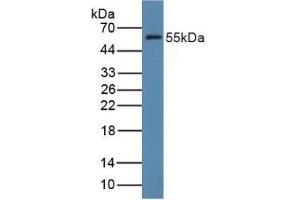 Detection of FDFT1 in Rat Liver Tissue using Polyclonal Antibody to Farnesyl Diphosphate Farnesyltransferase 1 (FDFT1) (FDFT1 antibody  (AA 269-417))