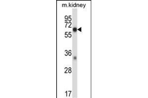 Mouse Map3k2 Antibody (N-term) (ABIN657838 and ABIN2846800) western blot analysis in mouse kidney tissue lysates (35 μg/lane).