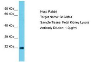 Image no. 1 for anti-Chromosome 12 Open Reading Frame 44 (C12orf44) (AA 29-78) antibody (ABIN6750653) (ATG101 antibody  (AA 29-78))