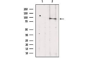 Western blot analysis of extracts from Hela, using TELO2 antibody.