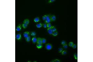 Image no. 1 for anti-Interferon-Induced Protein with Tetratricopeptide Repeats 1 (IFIT1) antibody (ABIN1498803) (IFIT1 antibody)